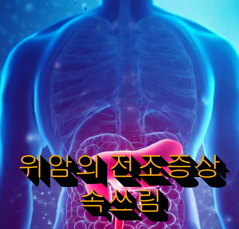 인체의 모습과 위암의 전조증상 속쓰림이라는 텍스트