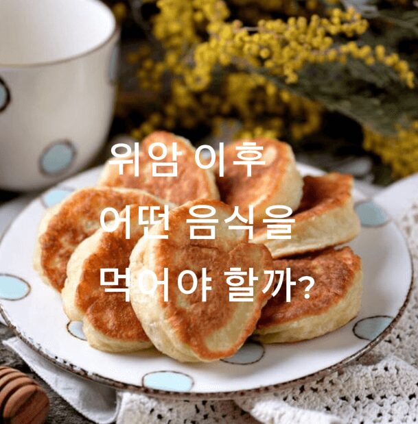 빵이 접시에 놓여 있다.